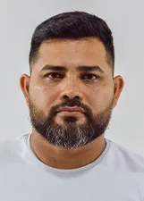 HELLMER GONÇALVES SANTARÉM