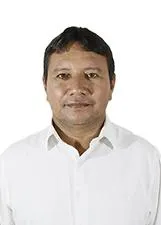 JALTELITON DA SILVA MEDEIROS