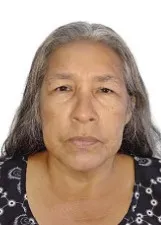 JACQUELINE TEIXEIRA LOBATO FIGUEREDO