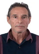 WALTER LOPES SIQUEIRA