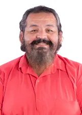 HERLON ALVES TEIXEIRA