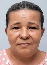 EUNICE DOS SANTOS NASCIMENTOS
