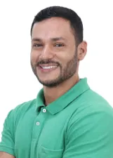 EMERSON ALBERT FERRZ PEREIRA