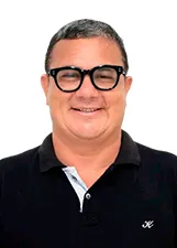 JOSÉ LEONILSON DO NASCIMENTO