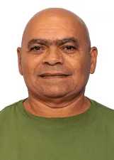 IVANILDO LUIZ DE ALBUQUERQUE