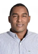 ´WESLEY CIRCUNCISAO COSTA